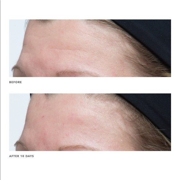 Algenist GENIUS Ultimate Anti-Aging Cream - Picture 4 of 6